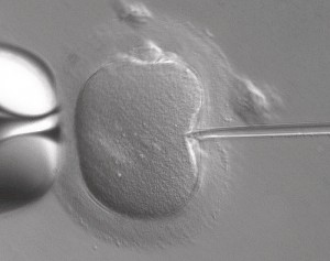 IVF: how many cycles can you have?